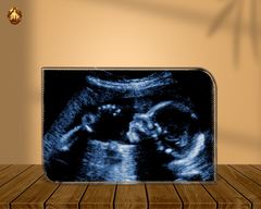 Baby Ultrasound Photo Crystal